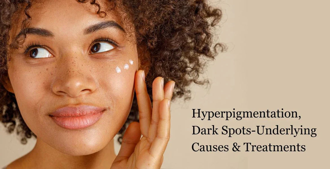 Hyperpigmentation,🤦🏿Dark Spots-Underlying 🤦🏿Causes  & Treatments🩺